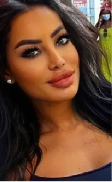 Trágico final de  modelo playboy tras cirugía estética en Republica Dominicana